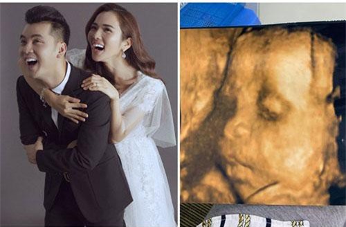 Bà xã Ưng Hoàng Phúc đăng ảnh siêu âm con thứ 3, hạnh phúc khoe mặt giống hệt anh ba Jonny
