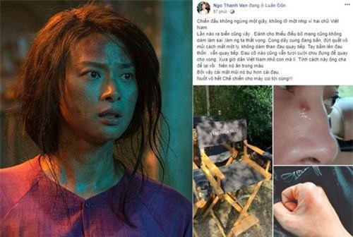 Ngô Thanh Vân bầm dập, chấn thương khi đóng phim ở nước ngoài