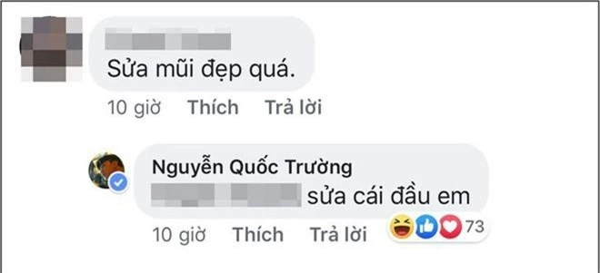 Nổi tiếng thân thiện nhưng cũng có ngày Quốc Trường gay gắt đáp trả chỉ vì bị nghi sửa mũi - Ảnh 2.