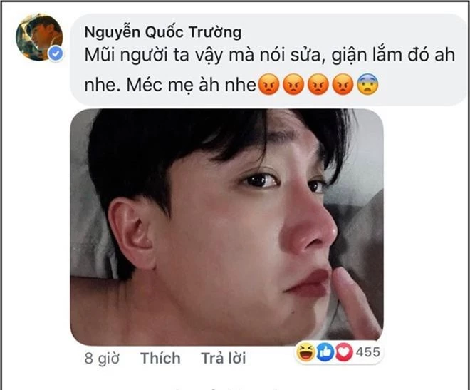 Nổi tiếng thân thiện nhưng cũng có ngày Quốc Trường gay gắt đáp trả chỉ vì bị nghi sửa mũi - Ảnh 3.