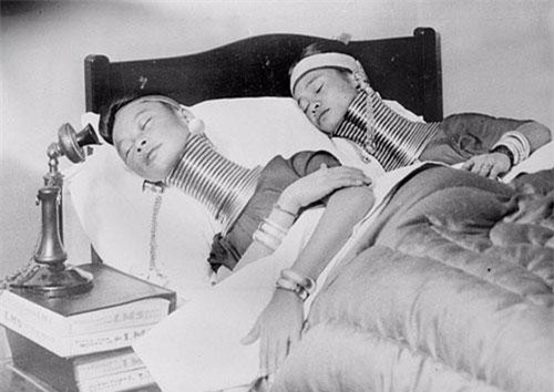 Những bức ảnh kỳ dị khiến người xem “lạnh gáy”