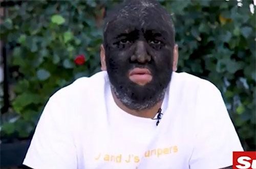 Clip: "Chuyện lạ" người đàn ông có 98% cơ thể bị lông che phủ