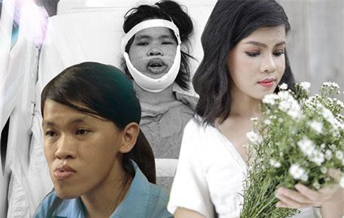 Cô gái lột xác đúng chuẩn "vịt hóa thiên nga" sau khi phẫu thuật thẩm mỹ khiến bao người chao đảo