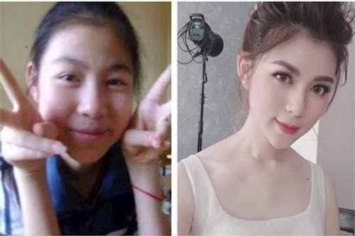 Hotgirl 10x "dậy thì thành công" phủ nhận tin đồn phẫu thuật thẩm mỹ