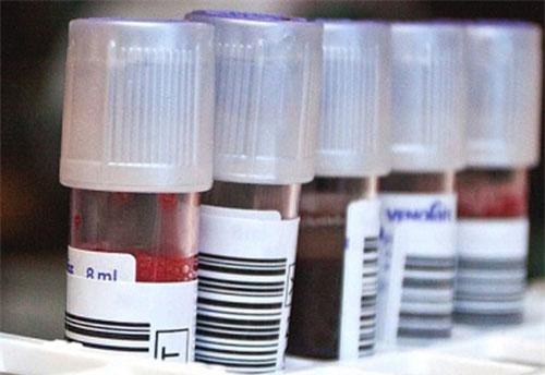 Đằng sau ba trường hợp bệnh nhân được chữa khỏi HIV