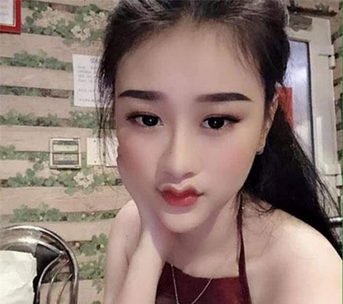 Hot trend môi cánh én biến dạng, chị em nghiện "dao kéo" rần rần chạy theo