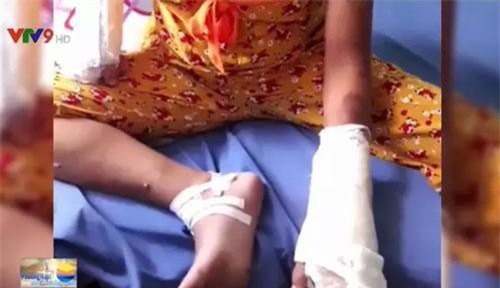 Bình Thuận: Giám định phụ nữ mang thai 7 tháng bị chồng đánh dã man