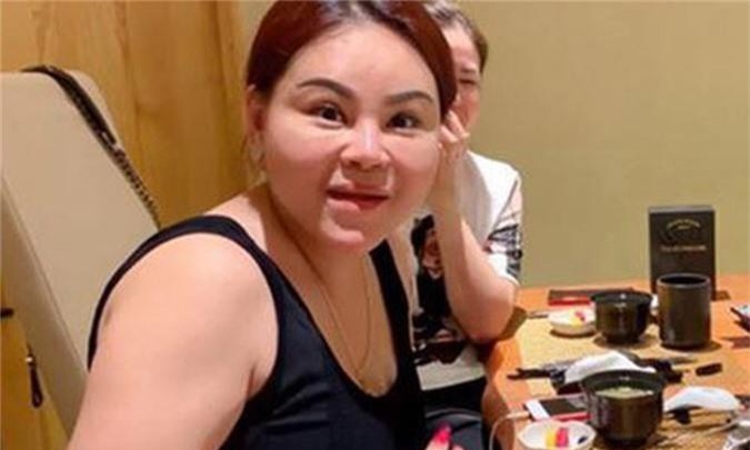 Sao Việt dao kéo đến biến dạng: Cơn nghiện thẩm mỹ bao giờ dừng? - Hình 2 Sao Viet dao keo den bien dang: Con nghien tham my bao gio dung?-Hinh-2