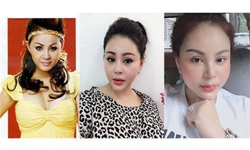 Sao Việt dao kéo đến biến dạng: Cơn nghiện thẩm mỹ bao giờ dừng