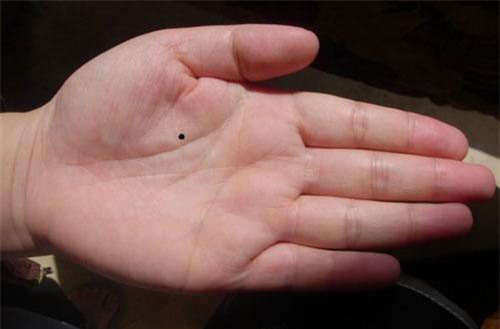 Nốt ruồi ở 4 vị trí 'lộc' này báo trước người phụ nữ mang mệnh quý nhân, cả đời 'ngồi rung đùi đếm tiền'