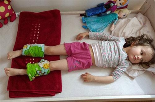 Mẹ buộc khăn và bắp chân con hạ sốt, ai cũng tưởng dở hơi nhưng hiệu quả lại vô cùng bất ngờ