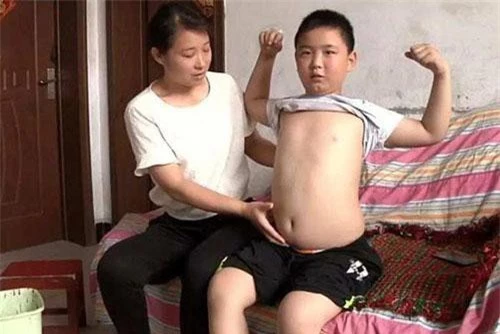 Cậu bé phấn đấu được "béo phì" chỉ để cứu bố