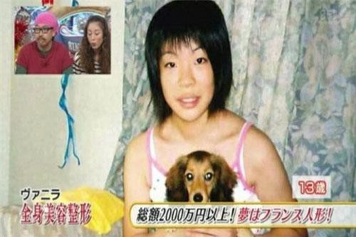 Thảm hoạ thẩm mỹ Nhật Bản: Bị bố ruột ruồng bỏ vì quá xấu, hàng trăm ca dao kéo bất chấp sinh mạng