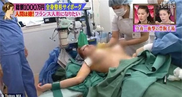Thảm hoạ thẩm mỹ Nhật Bản: Bị bố ruột ruồng bỏ vì quá xấu, hàng trăm ca dao kéo bất chấp sinh mạng và tâm sự buồn phía sau - Ảnh 5.