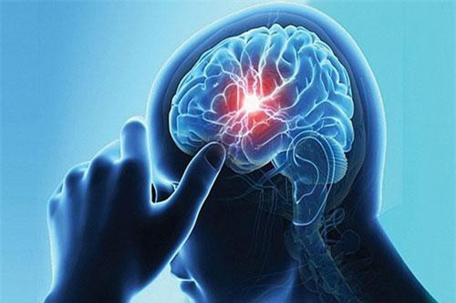 Người bị đột quỵ nên thực hiện chế độ ăn thế nào?