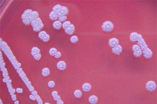 Mọi thông tin về căn bệnh "nhiễm khuẩn ăn thịt người" - Whitmore, đặc biệt là cách phòng ngừa cần lưu ý