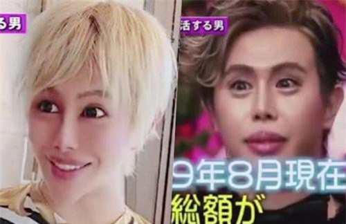"Mỹ nam mặt rắn" Nhật Bản gây sốc với quá trình dao kéo 25 tỷ đồng, lý do thẩm mỹ khiến netizen phải lắc đầu ngán ngẩm
