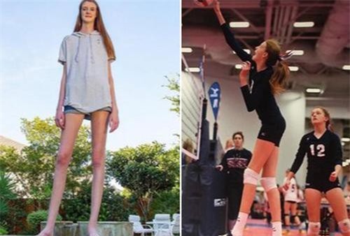 Cô gái mới 16 tuổi đã sở hữu chiều cao khủng, đôi chân dài kỷ lục 1,34m khiến ai cũng phải trầm trồ "chân dài tới nách" là có thật