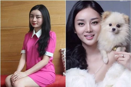 Angela Minh Châu trước và sau khi phẫu thuật thẩm mỹ.