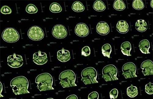 Phát hiện bí mật động trời về những đặc điểm chung của thiên tài