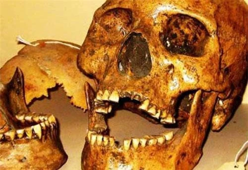 So sánh giữa bộ răng người bình thường và xương hàm của người khổng lồ.