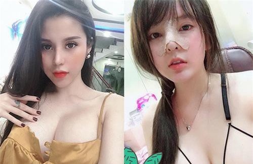Hai cô gái từng nổi tiếng khi công khai hình ảnh “đập mặt xây lại” của mình, sau vài năm cuộc sống ai cũng thay đổi đến chóng mặt
