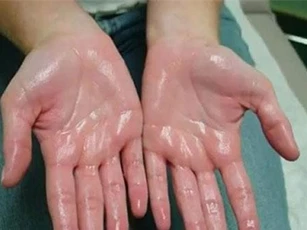 Thấy 4 dấu hiệu này trên cơ thể, hãy đi khám ngay kẻo quá muộn