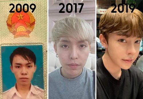 Chàng trai Đà Nẵng phẫu thuật thẩm mỹ 9 lần trong 10 năm