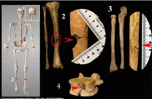 Lộ quái chiêu tra tấn rùng rợn bậc nhất thời Trung cổ