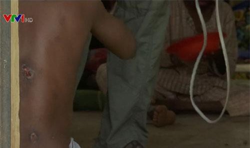 400 người bị tra tấn trong một căn nhà ở Nigeria