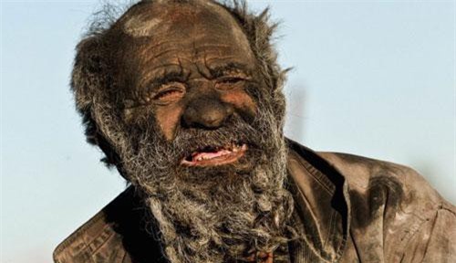 Phát hoảng với dị nhân 60 năm không tắm