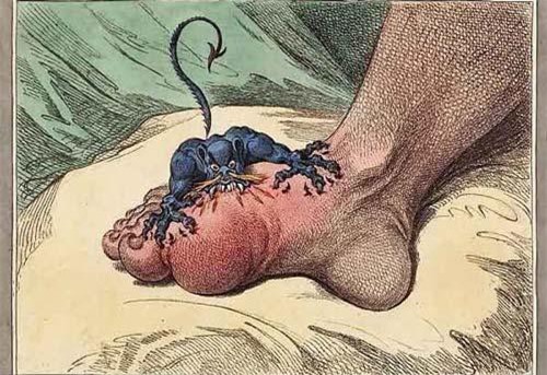 Hội chứng 'quỷ ám' tự ăn thịt mình và những uẩn khúc chưa có lời giải