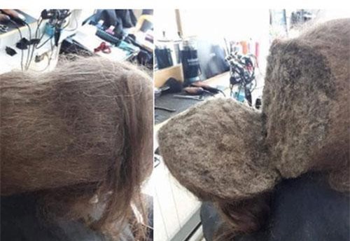 'Rợn người' chuyện cô gái không gội đầu thời gian dài và kết