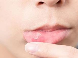 Đang 'khốn khổ' vì nhiệt miệng, hãy uống ngay loại nước ép này, điều thần kỳ sẽ xảy ra chỉ sau 1 đêm