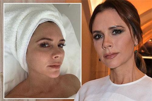 Để có làn da đẹp như Victoria Beckham