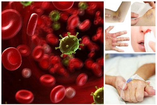 Ung thư máu nguy hiểm: Đây là những dấu hiệu sớm giúp bạn 'chặn cửa' ung thư