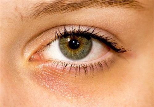 8 dấu hiệu sức khỏe nhiều người thường phớt lờ nhưng cực kỳ nguy hại