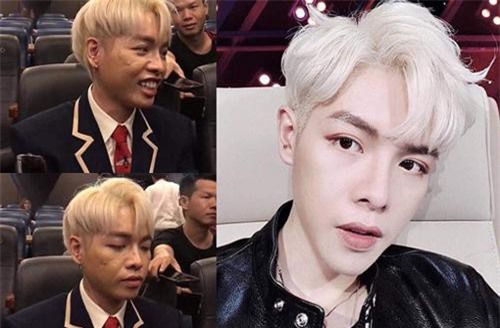 Khuôn mặt thay đổi hậu phẫu thuật thẩm mỹ của đôi bạn thân showbiz