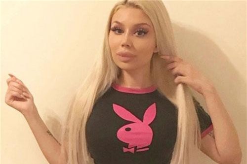 Cô gái phẫu thuật thẩm mỹ từ năm 13 tuổi, chi hàng tỷ đồng để thành 'búp bê sống'