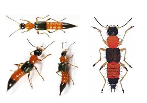 N&#x1ECD;c ki&#x1EBF;n ba khoang &#x111;&#x1ED9;c h&#x1A1;n r&#x1EAF;n h&#x1ED5; 15 l&#x1EA7;n, c&#xE1;ch ch&#x1EEF;a th&#x1EBF; n&#xE0;o?