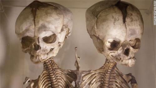 Top 10 bảo tàng y khoa kỳ dị nhất thế giới