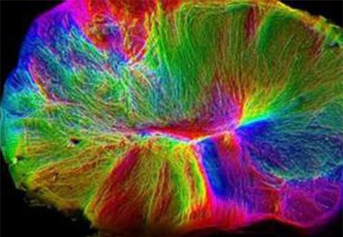 Các nhà khoa học Mỹ tạo ra não người thu nhỏ gây tranh cãi