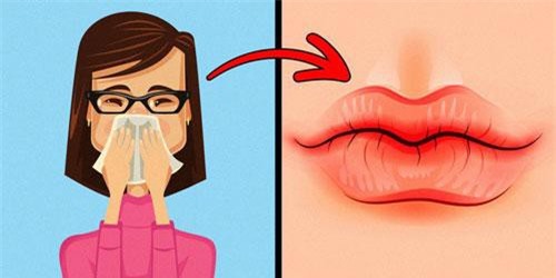 Dấu hiệu trên đôi môi nói lên vấn đề sức khỏe của bạn