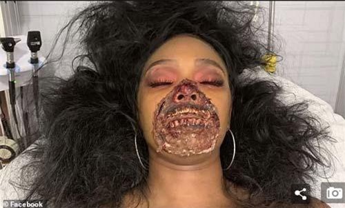 Cô gái hóa xác sống khiến ai cũng kinh hãi