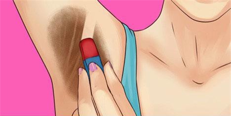 Công thức xóa bay thâm sạm cho vùng da dưới cánh tay