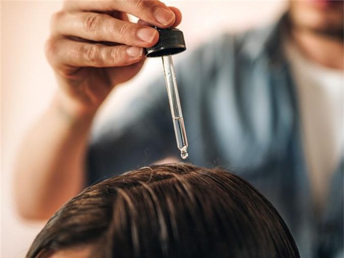 Bỏ túi 8 bí kíp ngăn ngừa gàu hiệu quả trong mùa hanh khô - Hình 3 Bo tui 8 bi kip ngan ngua gau hieu qua trong mua hanh kho-Hinh-3