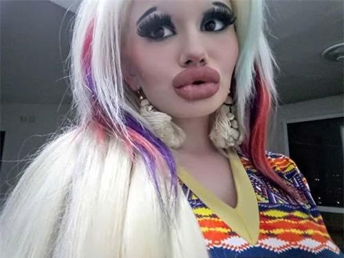 Hot girl môi xúc xích khiến ai nhìn thấy cũng phát hoảng