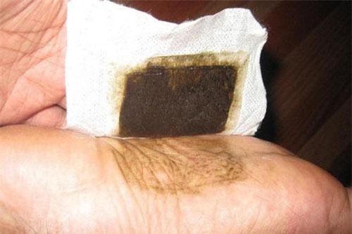 Thực hư tác dụng của miếng dán thải độc lòng bàn chân
