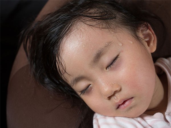 Mách các mẹ tuyệt chiêu điều trị chứng trẻ ra mồ hôi đầu cực hiệu quả