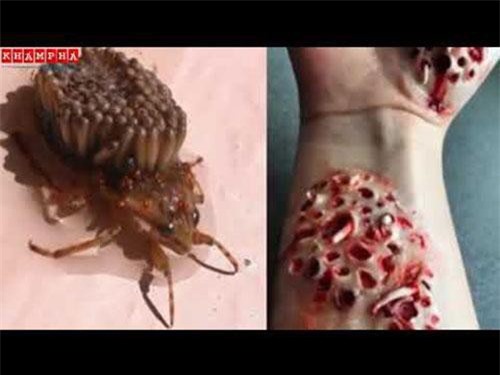 Clip: Đâu là căn bệnh đáng sợ nhất trên thế giới?